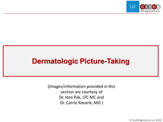 Dermatologic Picture-Taking


    (Images/information provided in this
          section are courtesy of
         Dr. Hon Pak, LTC MC and
          Dr. Carrie Kovarik, MD )


                                           © ClickDiagnostics, Inc. 2010
 