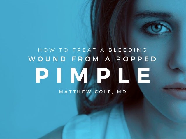pimple wound treatment
