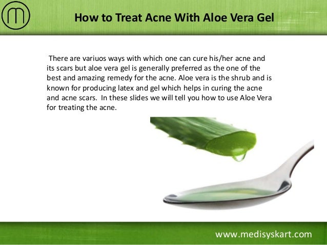 How To Treat Acne With Aloe Vera Gel