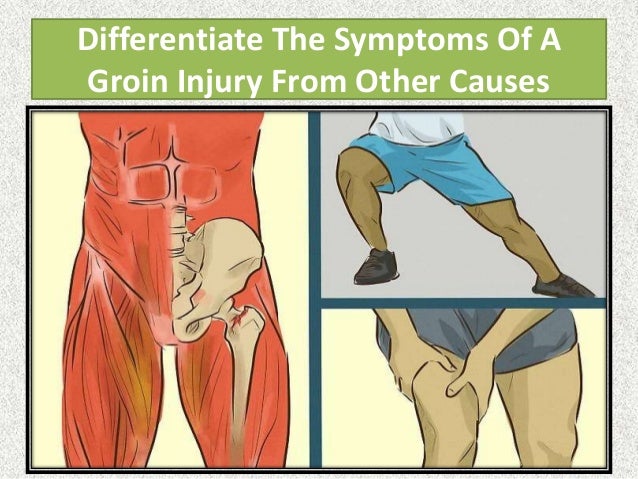 How to treat a groin injury