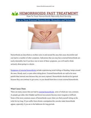 hemorrhoidstreatmentok.com
How to Treat External Hemorrhoids: Remedies and Solutions!
Hemorrhoids are described as swollen veins in and around the anus that cause discomfort and
can lead to a number of other symptoms. Indications that you may have external hemorrhoids are
easily detectable, but if you have one or more of these symptoms, you will need to think
seriously about going to a doctor.
Symptoms of external hemorrhoids include experiencing rectal itching or bleeding, lumps around
the anus, bloody stool, or pain when sitting down. External hemorrhoids are said to be more
painful than internal ones because they are more exposed. Hemorrhoids should not be ignored
because they can continue to get worse, so you should learn how to treat external hemorrhoids.
What Causes Them
There are many causes that can lead to external hemorrhoids, some of which are very common.
As people get older, their bladder and bowel movements become more irregular or difficult.
Some of the more common causes of hemorrhoids occur when you find yourself sitting on the
toilet for too long. If you suffer from chronic constipation this can also make hemorrhoids
appear, especially if you are in the bathroom for long periods.
 