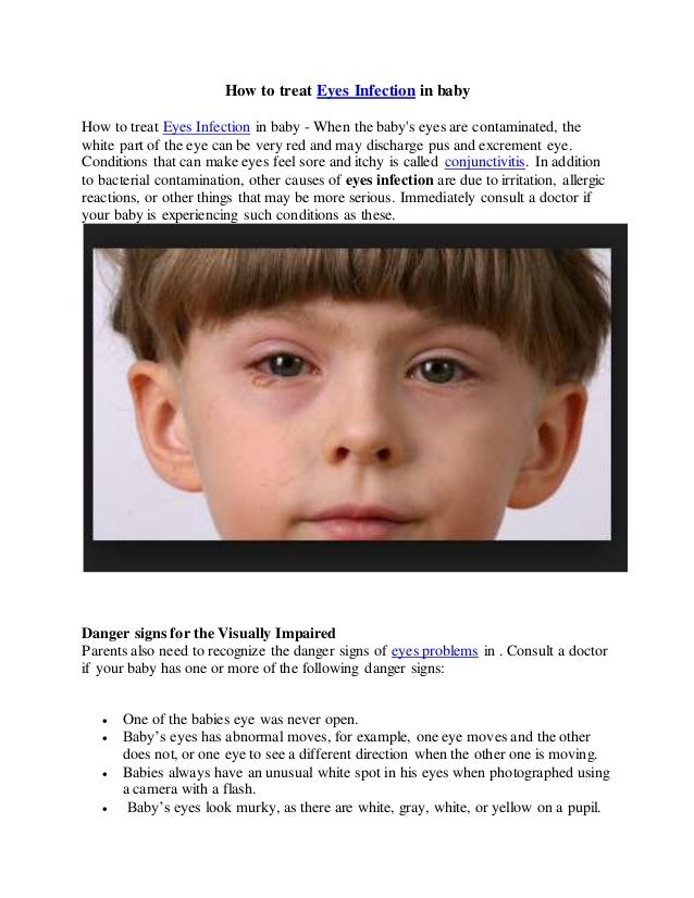 How to treat eyes infection in baby