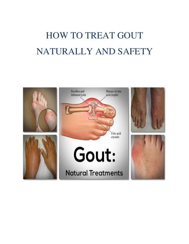 How To Treat The Gout Naturally How To Treat The Gout Naturally
