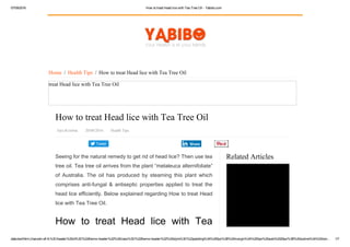 07/09/2016 How to treat Head lice with Tea Tree Oil ­ Yabibo.com
data:text/html;charset=utf­8,%3Cheader%20id%3D%22theme­header%22%20class%3D%22theme­header%22%20style%3D%22padding%3A%200px%3B%20margin%3A%200px%20auto%2025px%3B%20outline%3A%20non… 1/7
Tweet
Related Articles
Home  /  Health Tips  /  How to treat Head lice with Tea Tree Oil
treat Head lice with Tea Tree Oil
How to treat Head lice with Tea Tree Oil
Jaya Krishna   20/08/2016   Health Tips
Seeing for the natural remedy to get rid of head lice? Then use tea
tree oil. Tea tree oil arrives from the plant “melaleuca alternifoliate”
of  Australia.  The  oil  has  produced  by  steaming  this  plant  which
comprises  anti­fungal  &  antiseptic  properties  applied  to  treat  the
head lice efficiently. Below explained regarding How to treat Head
lice with Tea Tree Oil.
How  to  treat  Head  lice  with  Tea
Share
Amazing Medical Benefits of Ginger
 
 