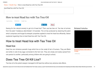07/09/2016 How to treat Head lice with Tea Tree Oil ­ Yabibo.com
data:text/html;charset=utf­8,%3Cdiv%20xmlns%3Av%3D%22http%3A%2F%2Frdf.data­vocabulary.org%2F%23%22%20id%3D%22crumbs%22%20style%3D%22padding%3A%200px%200px%205px%3B%20margin%3A%200… 1/7
Tweet
Related Articles
Amazing Medical Benefits of
Ginger
05/09/2016
Home  /  Health Tips  /  How to treat Head lice with Tea Tree Oil
treat Head lice with Tea Tree Oil
How to treat Head lice with Tea Tree Oil
Jaya Krishna   20/08/2016   Health Tips
Seeing for the natural remedy to get rid of head lice? Then use tea tree oil. Tea tree oil arrives
from the plant “melaleuca alternifoliate” of Australia. The oil has produced by steaming this plant
which comprises anti­fungal & antiseptic properties applied to treat the head lice efficiently. Below
explained regarding How to treat Head lice with Tea Tree Oil.
How to treat Head lice with Tea Tree Oil
Head lice
Head lice are miniature parasitic bugs which live on the scalp & hair of humans. They are Black
and white in color & lay eggs connected to the hair root. They are simply and easily spread from
one person to another, particularly among children who are going to school.
Does Tea Tree Oil Kill Lice?
Tea tree oil is the potent weapon managed to kill head lice without any adverse side effects.
Share
Amazing Medical Benefits of Ginger
 
 