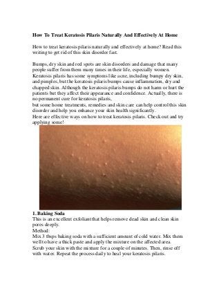 How To Treat Keratosis Pilaris Naturally And Effectively At Home 
How to treat keratosis pilaris naturally and effectively at home? Read this writing to get rid of this skin disorder fast. 
Bumps, dry skin and red spots are skin disorders and damage that many people suffer from them many times in their life, especially women. 
Keratosis pilaris has some symptoms like acne, including bumpy dry skin, and pimples, but the keratosis pilaris bumps cause inflammation, dry and chapped skin. Although the keratosis pilaris bumps do not harm or hurt the patients but they affect their appearance and confidence. Actually, there is no permanent cure for keratosis pilaris, 
but some home treatments, remedies and skin care can help control this skin disorder and help you enhance your skin health significantly. 
Here are effective ways on how to treat keratosis pilaris. Check out and try applying some! 
1. Baking Soda 
This is an excellent exfoliant that helps remove dead skin and clean skin pores deeply. 
Method: 
Mix 3 tbsps baking soda with a sufficient amount of cold water. Mix them well to have a thick paste and apply the mixture on the affected area. 
Scrub your skin with the mixture for a couple of minutes. Then, rinse off with water. Repeat the process daily to heal your keratosis pilaris.  