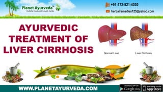 WWW.PLANETAYURVEDA.COM
herbalremedies123@yahoo.com
+91-172-521-4030
AYURVEDIC
TREATMENT OF
LIVER CIRRHOSIS
 