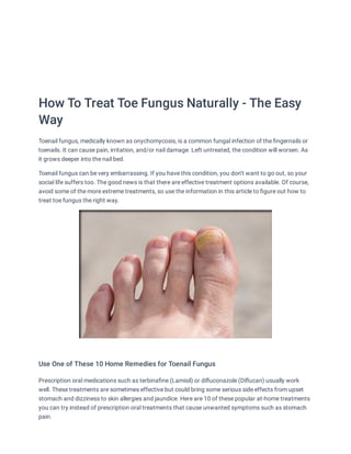 How To Treat Toe Fungus Naturally - The Easy
Way
Toenail fungus, medically known as onychomycosis, is a common fungal infection of the fingernails or
toenails. It can cause pain, irritation, and/or nail damage. Left untreated, the condition will worsen. As
it grows deeper into the nail bed.
Toenail fungus can be very embarrassing. If you have this condition, you don’t want to go out, so your
social life suffers too. The good news is that there are effective treatment options available. Of course,
avoid some of the more extreme treatments, so use the information in this article to figure out how to
treat toe fungus the right way.


Use One of These 10 Home Remedies for Toenail Fungus
Prescription oral medications such as terbinafine (Lamisil) or difluconazole (Diflucan) usually work
well. These treatments are sometimes effective but could bring some serious side effects from upset
stomach and dizziness to skin allergies and jaundice. Here are 10 of these popular at-home treatments
you can try instead of prescription oral treatments that cause unwanted symptoms such as stomach
pain.
 