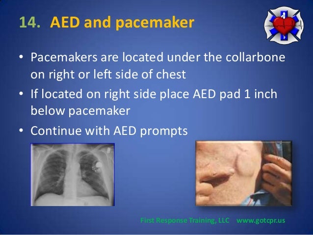 How to use an Automated External Defibrillator (AED)