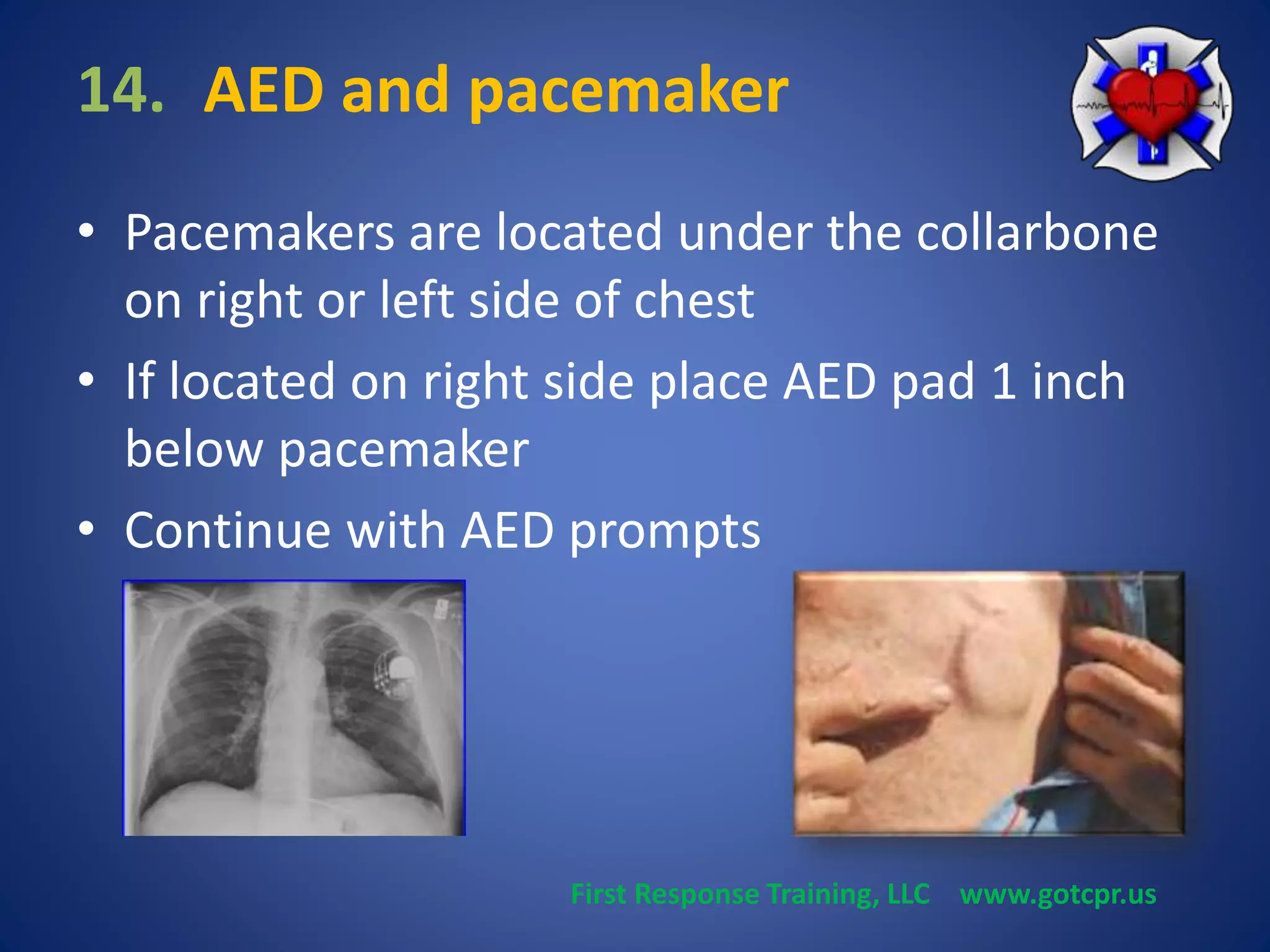 14. AED and pacemaker 
• Pacemakers are located under the collarbone 
on right or left side of chest 
• If located on right side place AED pad 1 inch 
below pacemaker 
• Continue with AED prompts 
First Response Training, LLC www.gotcpr.us 
 