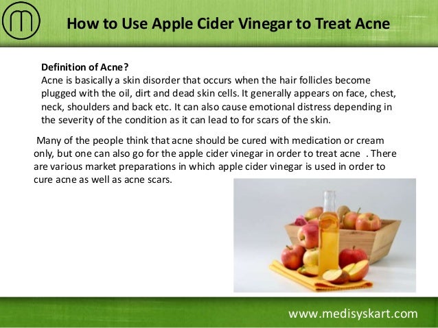 Apple cider vinegar for acne scars