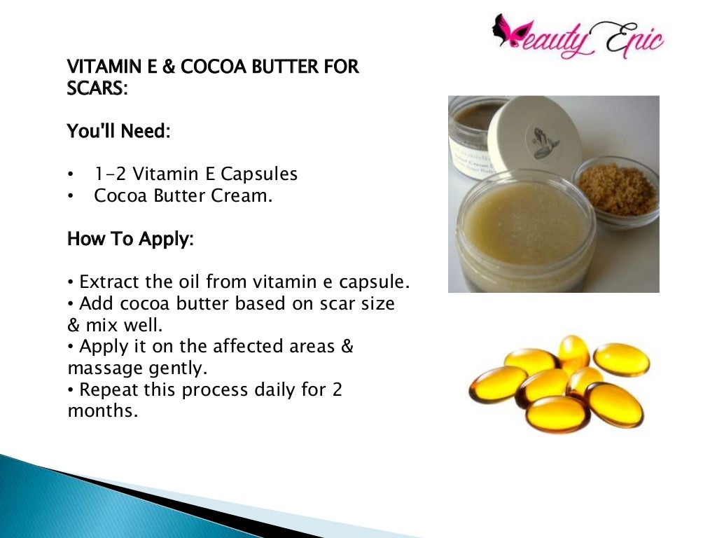 How To Use Cocoa Butter For Scars