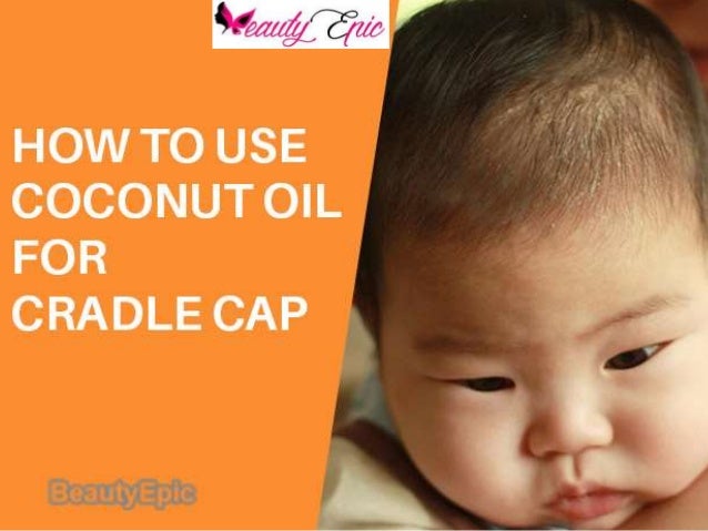 coconut oil for cradle cap