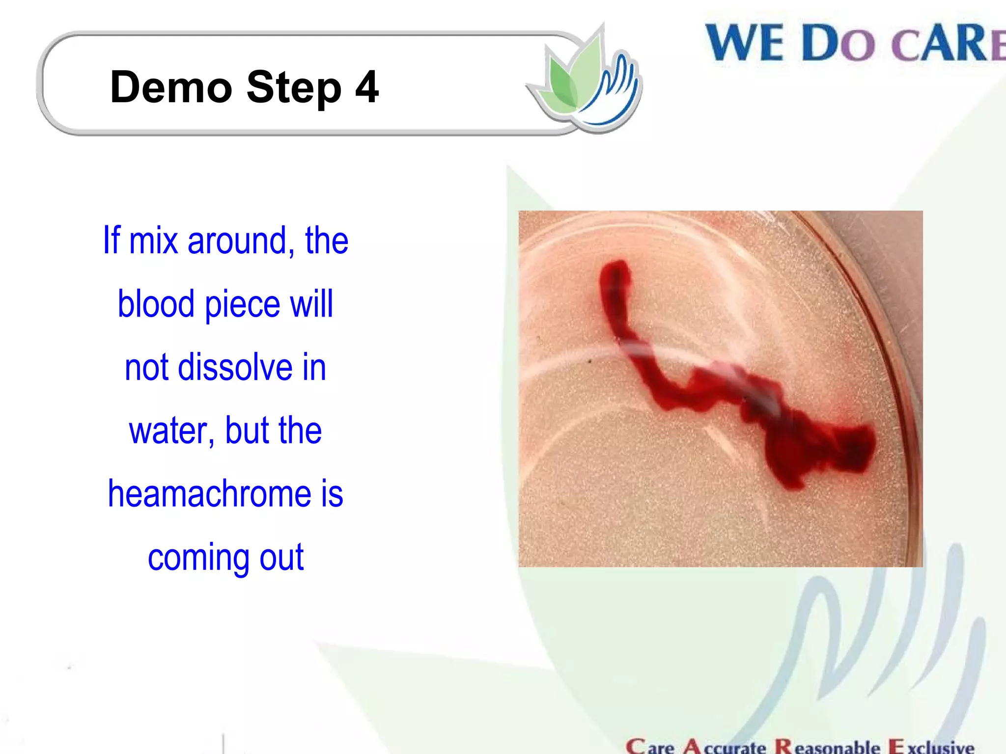 Demo Step 4


If mix around, the
 blood piece will
 not dissolve in
 water, but the
heamachrome is
   coming out
 