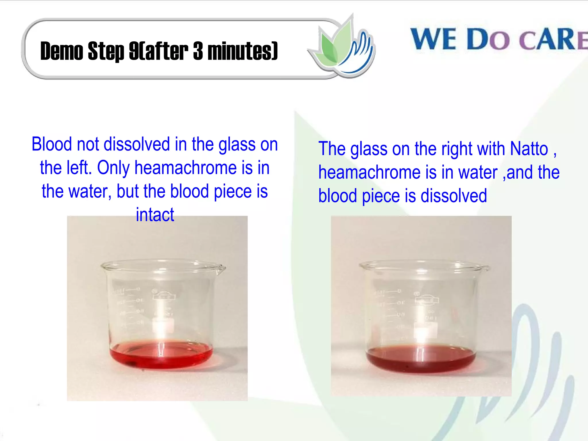 Demo Step 9(after 3 minutes)


Blood not dissolved in the glass on   The glass on the right with Natto ,
 the left. Only heamachrome is in     heamachrome is in water ,and the
 the water, but the blood piece is    blood piece is dissolved
                intact
 