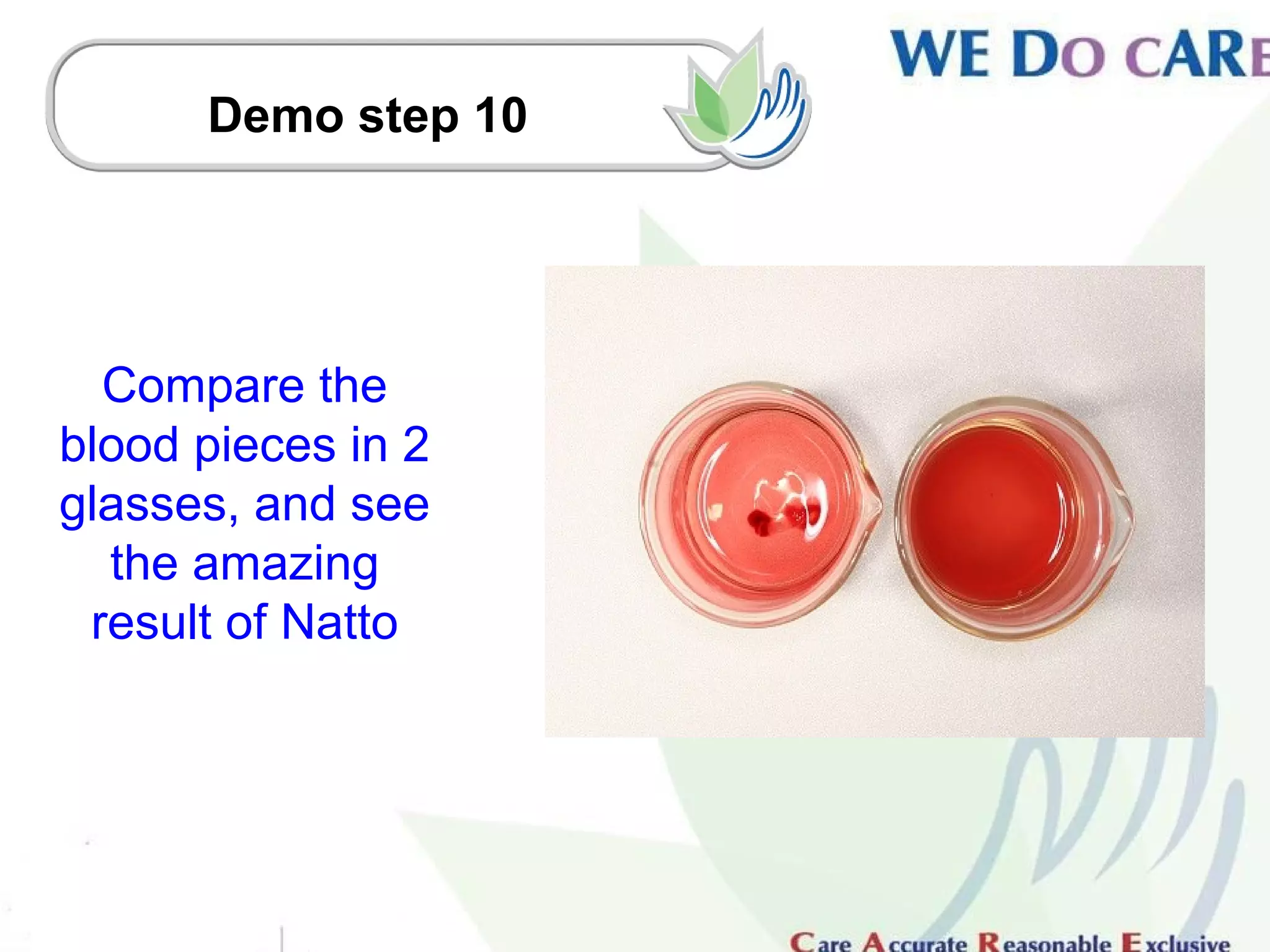 Demo step 10




  Compare the
blood pieces in 2
glasses, and see
  the amazing
 result of Natto
 