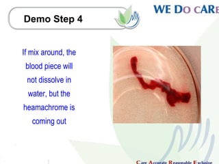 Demo Step 4


If mix around, the
 blood piece will
 not dissolve in
 water, but the
heamachrome is
   coming out
 