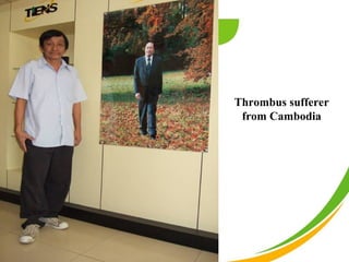 Thrombus sufferer
 from Cambodia
 