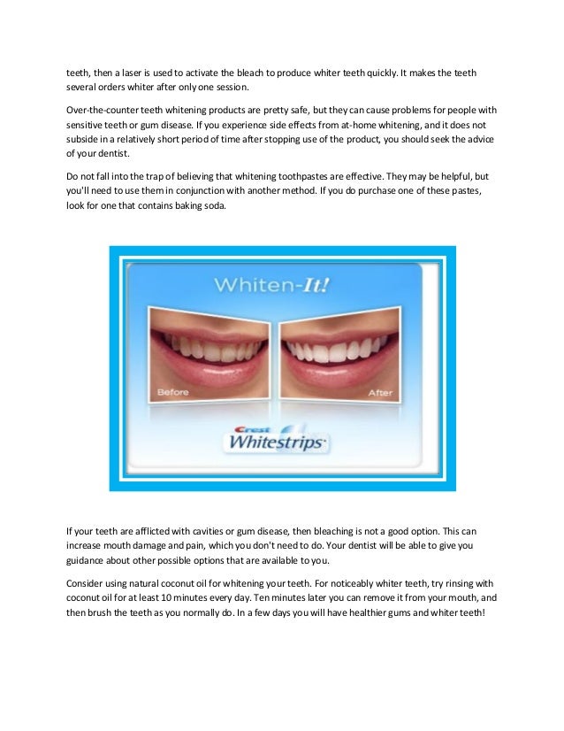 How to use crest whitestrips