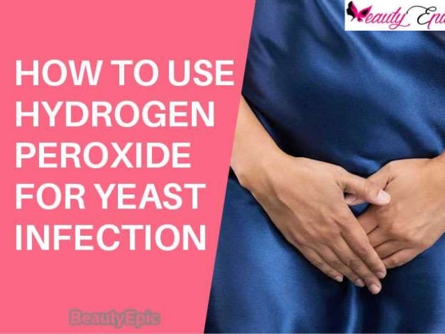 How To Use Hydrogen Peroxide For Yeast Infection