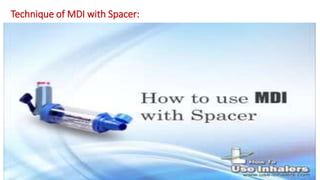Technique of MDI with Spacer:
 
