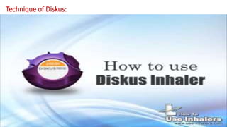 Technique of Diskus:
 