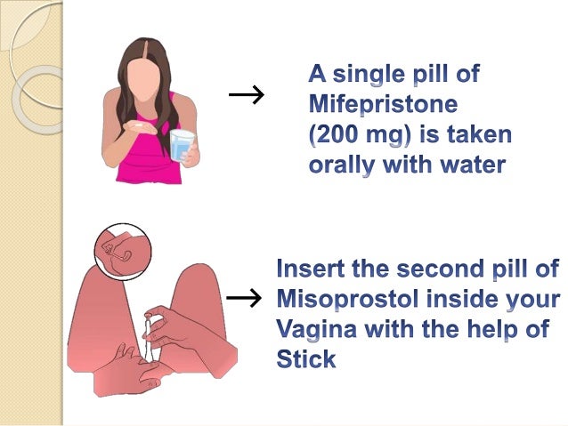 used misoprostol alone vaginal of Effects Gay boy double penetration