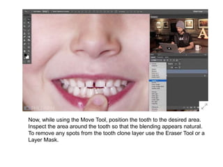 Now, while using the Move Tool, position the tooth to the desired area.
Inspect the area around the tooth so that the blending appears natural.
To remove any spots from the tooth clone layer use the Eraser Tool or a
Layer Mask.
 