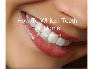 How To Whiten Teeth  At Home Easy, Effective & Quick 