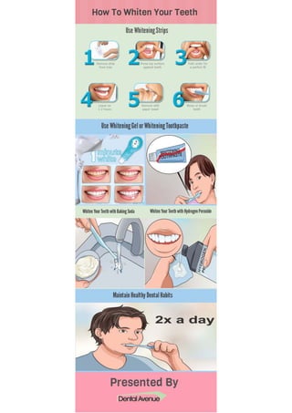 How to Whiten Your Teeth