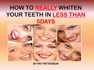 HOW TO REALLY WHITEN
YOUR TEETH IN LESS THAN
        5DAYS




       BY PAT PATTERSON
 