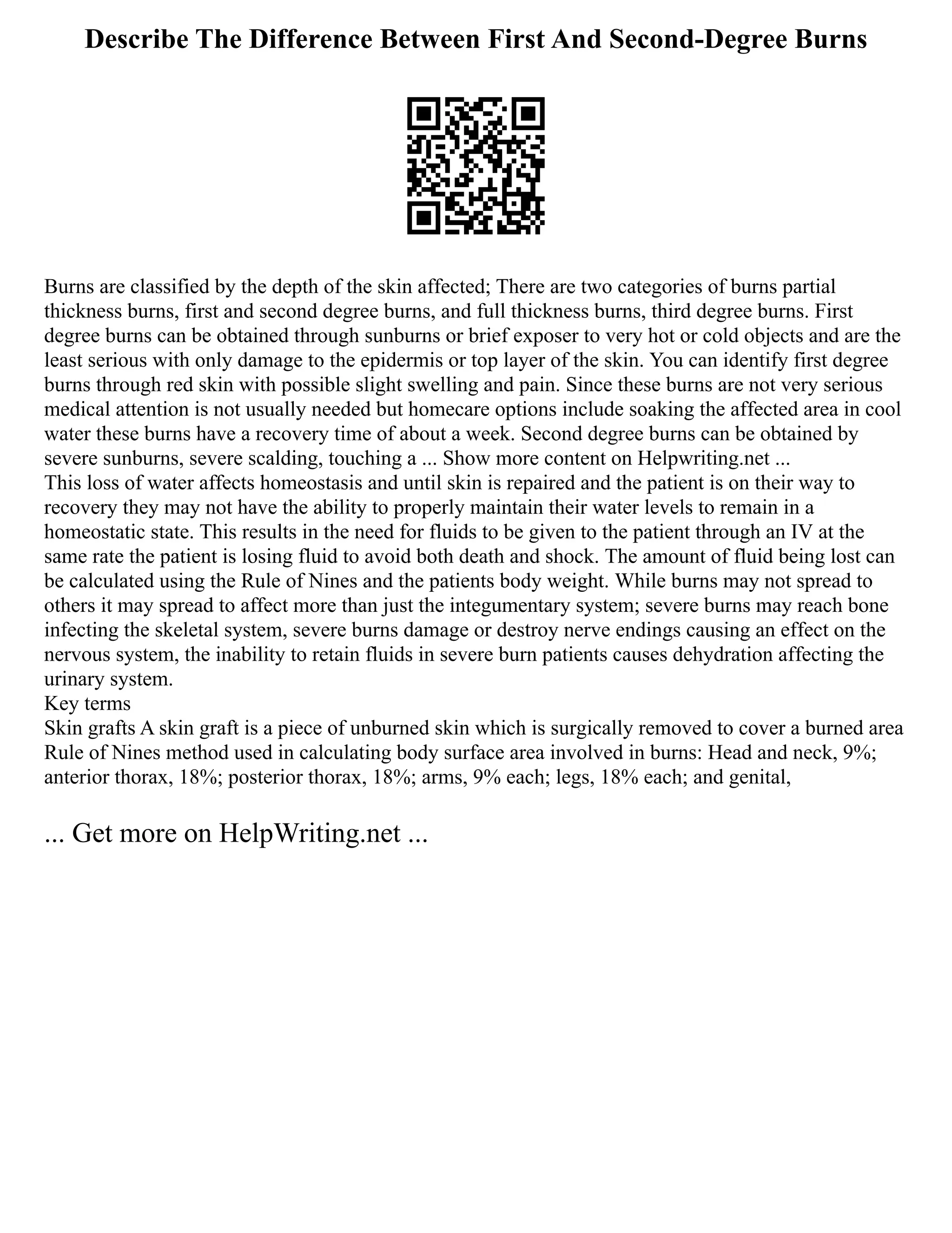 Describe The Difference Between First And Second-Degree Burns
Burns are classified by the depth of the skin affected; There are two categories of burns partial
thickness burns, first and second degree burns, and full thickness burns, third degree burns. First
degree burns can be obtained through sunburns or brief exposer to very hot or cold objects and are the
least serious with only damage to the epidermis or top layer of the skin. You can identify first degree
burns through red skin with possible slight swelling and pain. Since these burns are not very serious
medical attention is not usually needed but homecare options include soaking the affected area in cool
water these burns have a recovery time of about a week. Second degree burns can be obtained by
severe sunburns, severe scalding, touching a ... Show more content on Helpwriting.net ...
This loss of water affects homeostasis and until skin is repaired and the patient is on their way to
recovery they may not have the ability to properly maintain their water levels to remain in a
homeostatic state. This results in the need for fluids to be given to the patient through an IV at the
same rate the patient is losing fluid to avoid both death and shock. The amount of fluid being lost can
be calculated using the Rule of Nines and the patients body weight. While burns may not spread to
others it may spread to affect more than just the integumentary system; severe burns may reach bone
infecting the skeletal system, severe burns damage or destroy nerve endings causing an effect on the
nervous system, the inability to retain fluids in severe burn patients causes dehydration affecting the
urinary system.
Key terms
Skin grafts A skin graft is a piece of unburned skin which is surgically removed to cover a burned area
Rule of Nines method used in calculating body surface area involved in burns: Head and neck, 9%;
anterior thorax, 18%; posterior thorax, 18%; arms, 9% each; legs, 18% each; and genital,
... Get more on HelpWriting.net ...
 