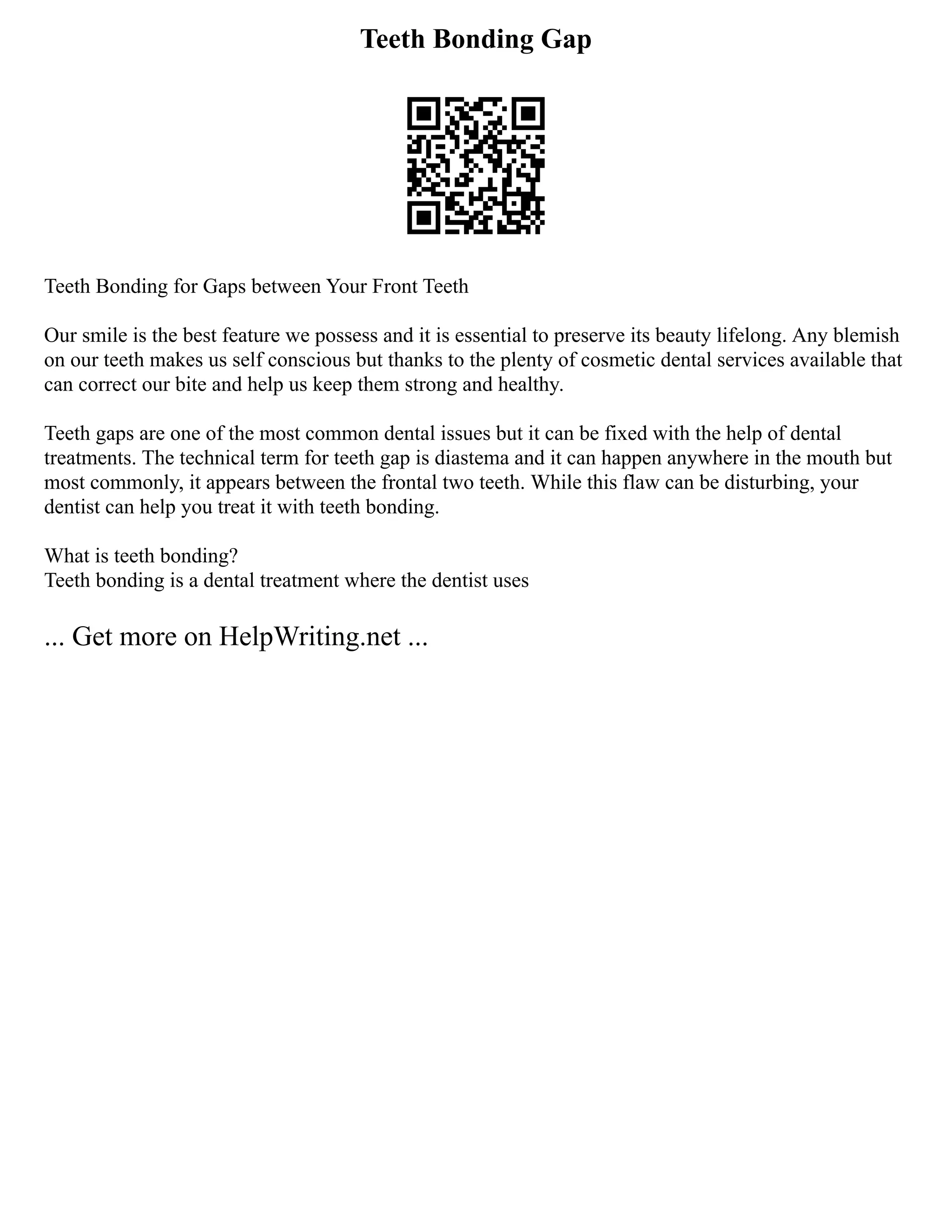 Teeth Bonding Gap
Teeth Bonding for Gaps between Your Front Teeth
Our smile is the best feature we possess and it is essential to preserve its beauty lifelong. Any blemish
on our teeth makes us self conscious but thanks to the plenty of cosmetic dental services available that
can correct our bite and help us keep them strong and healthy.
Teeth gaps are one of the most common dental issues but it can be fixed with the help of dental
treatments. The technical term for teeth gap is diastema and it can happen anywhere in the mouth but
most commonly, it appears between the frontal two teeth. While this flaw can be disturbing, your
dentist can help you treat it with teeth bonding.
What is teeth bonding?
Teeth bonding is a dental treatment where the dentist uses
... Get more on HelpWriting.net ...
 