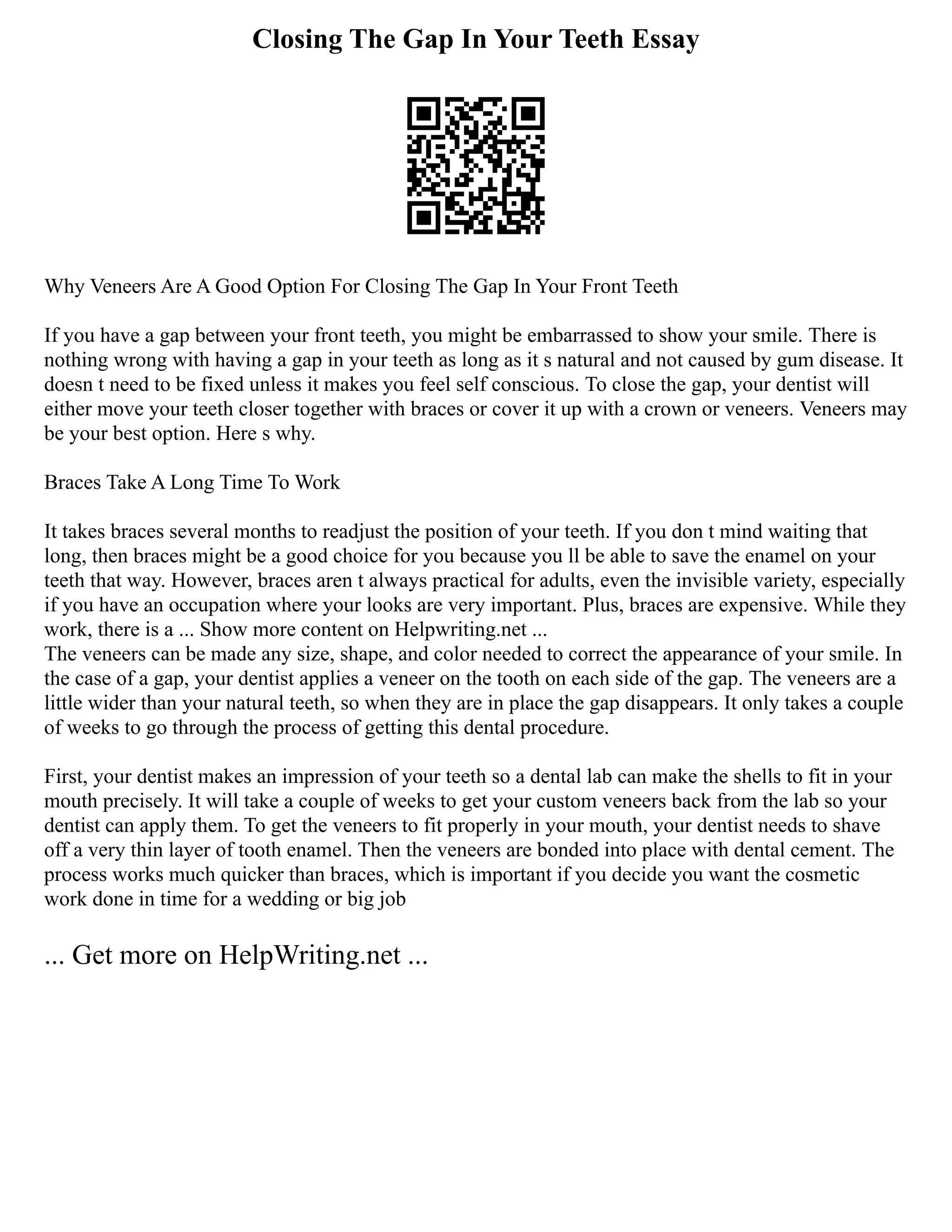 Closing The Gap In Your Teeth Essay
Why Veneers Are A Good Option For Closing The Gap In Your Front Teeth
If you have a gap between your front teeth, you might be embarrassed to show your smile. There is
nothing wrong with having a gap in your teeth as long as it s natural and not caused by gum disease. It
doesn t need to be fixed unless it makes you feel self conscious. To close the gap, your dentist will
either move your teeth closer together with braces or cover it up with a crown or veneers. Veneers may
be your best option. Here s why.
Braces Take A Long Time To Work
It takes braces several months to readjust the position of your teeth. If you don t mind waiting that
long, then braces might be a good choice for you because you ll be able to save the enamel on your
teeth that way. However, braces aren t always practical for adults, even the invisible variety, especially
if you have an occupation where your looks are very important. Plus, braces are expensive. While they
work, there is a ... Show more content on Helpwriting.net ...
The veneers can be made any size, shape, and color needed to correct the appearance of your smile. In
the case of a gap, your dentist applies a veneer on the tooth on each side of the gap. The veneers are a
little wider than your natural teeth, so when they are in place the gap disappears. It only takes a couple
of weeks to go through the process of getting this dental procedure.
First, your dentist makes an impression of your teeth so a dental lab can make the shells to fit in your
mouth precisely. It will take a couple of weeks to get your custom veneers back from the lab so your
dentist can apply them. To get the veneers to fit properly in your mouth, your dentist needs to shave
off a very thin layer of tooth enamel. Then the veneers are bonded into place with dental cement. The
process works much quicker than braces, which is important if you decide you want the cosmetic
work done in time for a wedding or big job
... Get more on HelpWriting.net ...
 