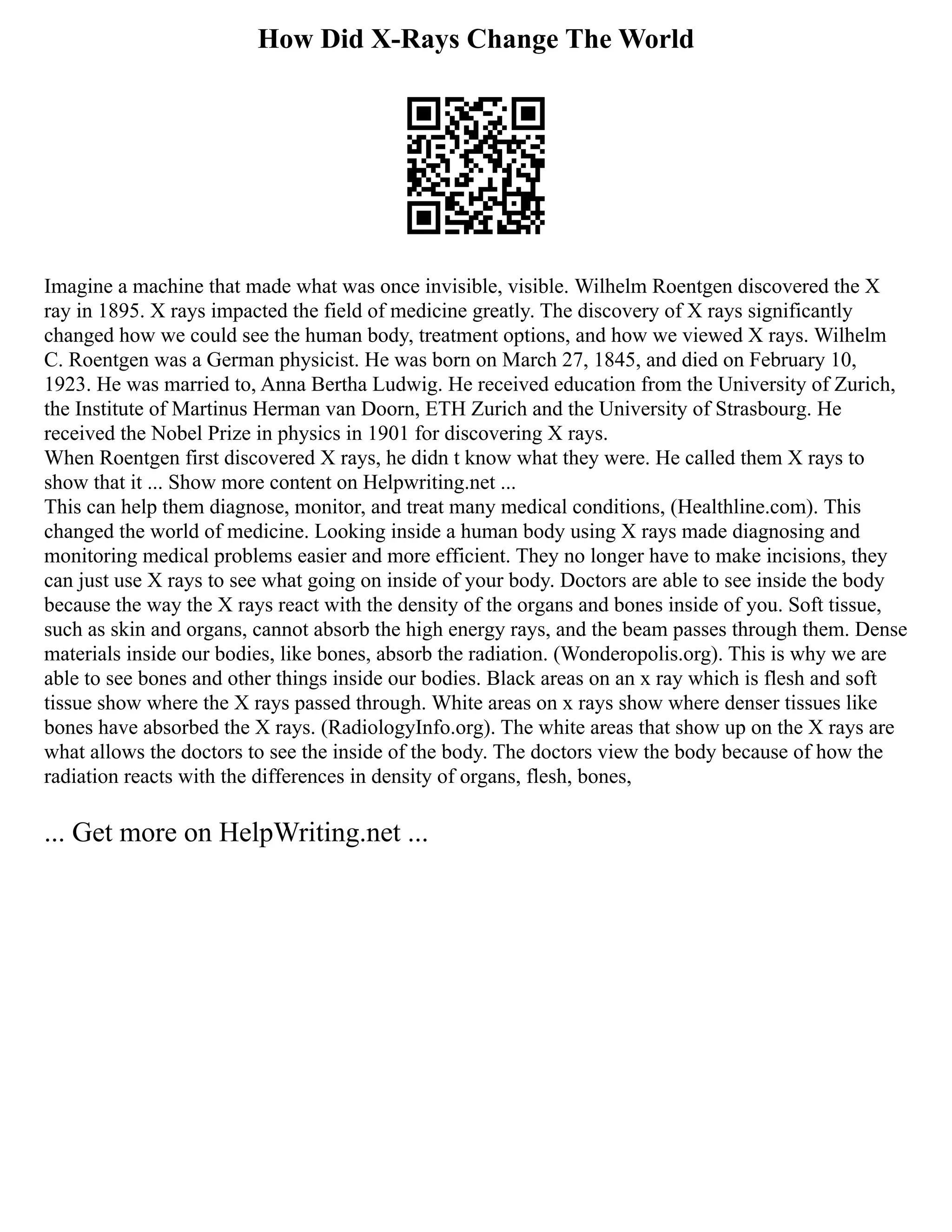 How Did X-Rays Change The World
Imagine a machine that made what was once invisible, visible. Wilhelm Roentgen discovered the X
ray in 1895. X rays impacted the field of medicine greatly. The discovery of X rays significantly
changed how we could see the human body, treatment options, and how we viewed X rays. Wilhelm
C. Roentgen was a German physicist. He was born on March 27, 1845, and died on February 10,
1923. He was married to, Anna Bertha Ludwig. He received education from the University of Zurich,
the Institute of Martinus Herman van Doorn, ETH Zurich and the University of Strasbourg. He
received the Nobel Prize in physics in 1901 for discovering X rays.
When Roentgen first discovered X rays, he didn t know what they were. He called them X rays to
show that it ... Show more content on Helpwriting.net ...
This can help them diagnose, monitor, and treat many medical conditions, (Healthline.com). This
changed the world of medicine. Looking inside a human body using X rays made diagnosing and
monitoring medical problems easier and more efficient. They no longer have to make incisions, they
can just use X rays to see what going on inside of your body. Doctors are able to see inside the body
because the way the X rays react with the density of the organs and bones inside of you. Soft tissue,
such as skin and organs, cannot absorb the high energy rays, and the beam passes through them. Dense
materials inside our bodies, like bones, absorb the radiation. (Wonderopolis.org). This is why we are
able to see bones and other things inside our bodies. Black areas on an x ray which is flesh and soft
tissue show where the X rays passed through. White areas on x rays show where denser tissues like
bones have absorbed the X rays. (RadiologyInfo.org). The white areas that show up on the X rays are
what allows the doctors to see the inside of the body. The doctors view the body because of how the
radiation reacts with the differences in density of organs, flesh, bones,
... Get more on HelpWriting.net ...
 
