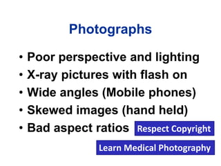 Photographs
• Poor perspective and lighting
• X-ray pictures with flash on
• Wide angles (Mobile phones)
• Skewed images (hand held)
• Bad aspect ratios
Learn Medical Photography
Respect Copyright
 