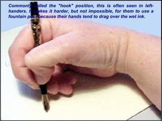 Commonly called the "hook" position, this is often seen in left-
handers. It makes it harder, but not impossible, for them to use a
fountain pen, because their hands tend to drag over the wet ink.
 