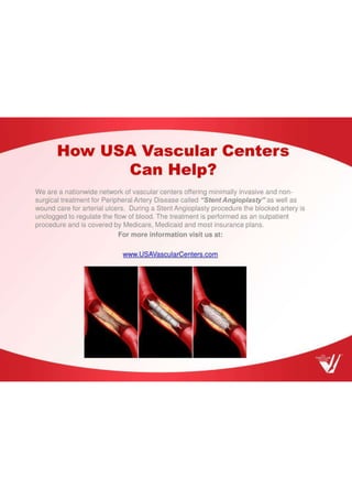 How USA Vascular Centers can Help.pdf