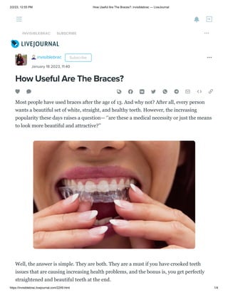 2/2/23, 12:55 PM How Useful Are The Braces?: invisiblebrac — LiveJournal
https://invisiblebrac.livejournal.com/2249.html 1/4
How Useful Are The Braces?
Most people have used braces after the age of 13. And why not? After all, every person
wants a beautiful set of white, straight, and healthy teeth. However, the increasing
popularity these days raises a question— ‘’are these a medical necessity or just the means
to look more beautiful and attractive?’’
Well, the answer is simple. They are both. They are a must if you have crooked teeth
issues that are causing increasing health problems, and the bonus is, you get perfectly
straightened and beautiful teeth at the end.
invisiblebrac
January 18 2023, 11:40
Subscribe
INVISIBLEBRAC SUBSCRIBE
 