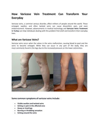 How Varicose Vein Treatment Can Transform Your
Everyday
Varicose veins, a common venous disorder, affect millions of people around the world. These
enlarged, swollen, and often twisted veins can cause discomfort, pain, and even
embarrassment. However, advancements in medical technology and Varicose Veins Treatment
in Turkey can help individuals dealing with this problem find relief and transform their everyday
lives.
What are Varicose Veins?
Varicose veins occur when the valves in the veins malfunction, causing blood to pool and the
veins to become enlarged. While they can occur in any part of the body, they are
most commonly found in the legs due to the increased pressure on the lower extremities.
Some common symptoms of varicose veins include:
 Visible swollen and twisted veins
 Aching or pain in the affected area
 Heavy or tired legs
 Burning or throbbing sensation
 Itching around the veins
 