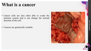 Hox genes and their role in cancers. | PDF