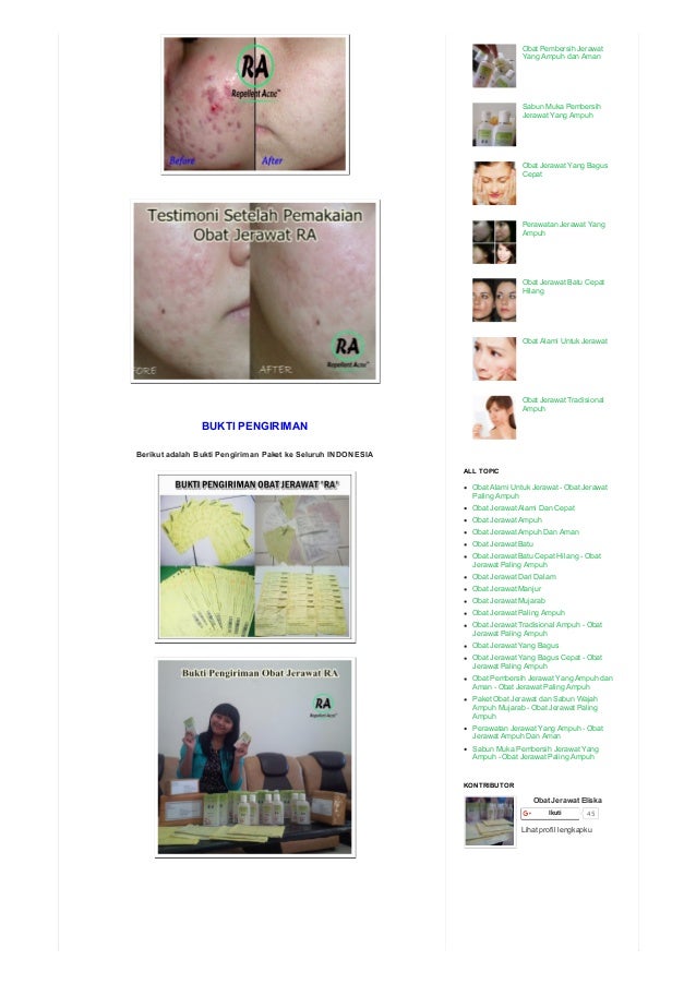 Hp 0856 0211 5032 obat jerawat ampuh di apotik, obat jerawat punggung