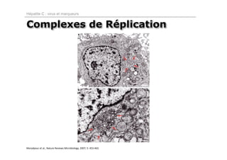 Hépatite C : virus et marqueurs


Complexes de Réplication




Moradpour et al., Nature Reviews Microbiology, 2007; 5: 453‐463.
 