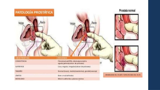 Prednisone price