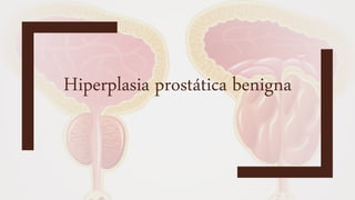 Hiperplasia prostática benigna
 