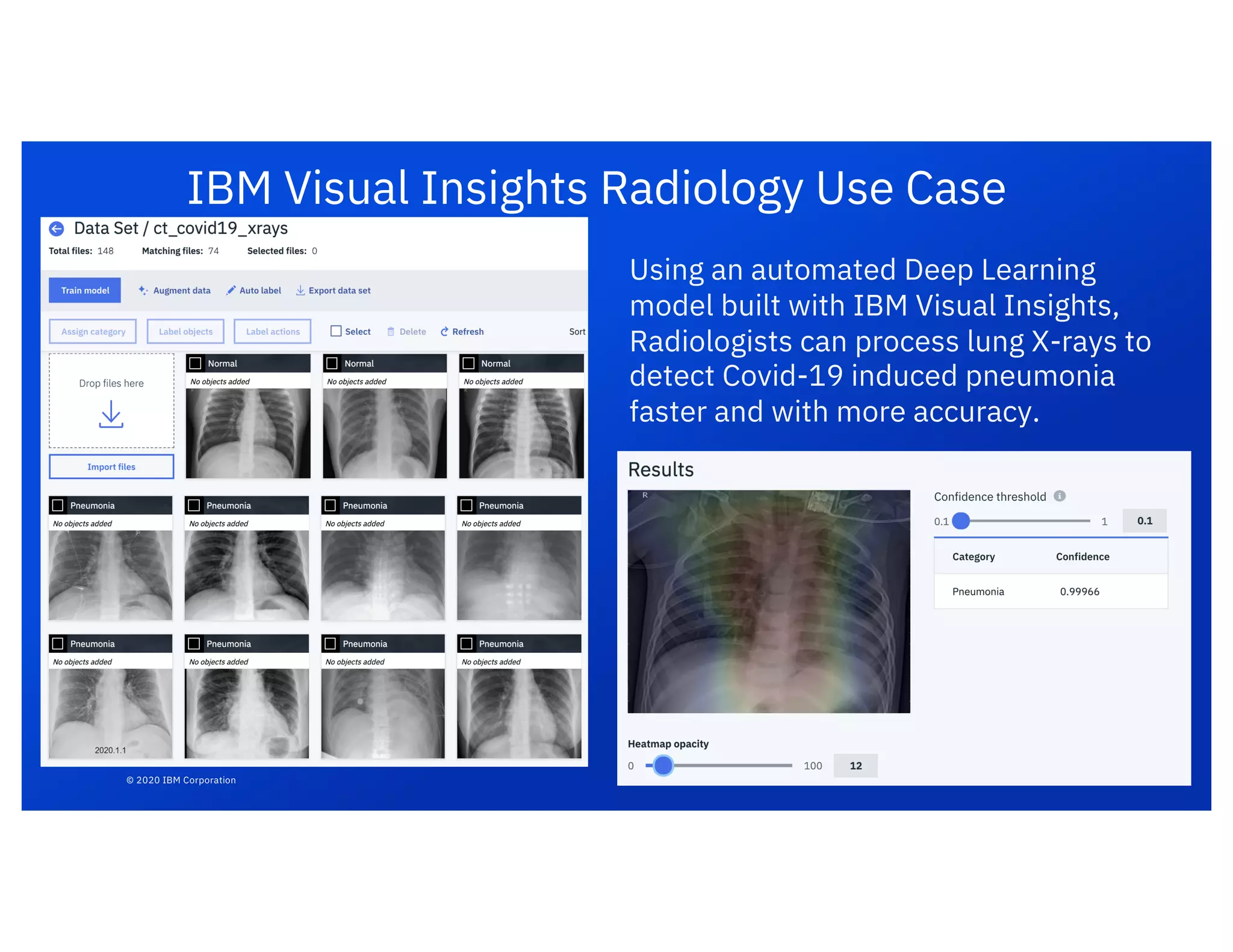 IBM Visual Insights Radiology Use Case
Using an automated Deep Learning
model built with IBM Visual Insights,
Radiologists can process lung X-rays to
detect Covid-19 induced pneumonia
faster and with more accuracy.
© 2020 IBM Corporation
 