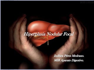 Hiperplasia Nodular Focal