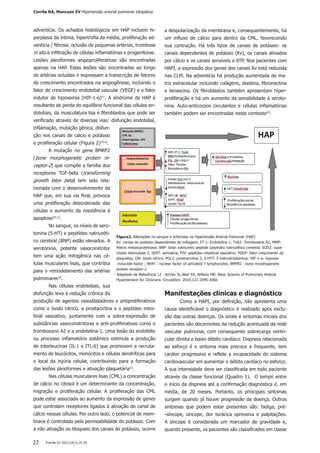 Pulmão RJ 2015;24(2):25-2927
adventícia. Os achados histológicos em HAP incluem hi-
perplasia da íntima, hipertrofia da média, proliferação ad-
ventícia / fibrose, oclusão de pequenas artérias, trombose
in situ e infiltração de células inflamatórias e progenitoras.
Lesões plexiformes angioproliferativas são encontradas
apenas na HAP. Estas lesões são encontradas ao longo
de artérias ocluídas e expressam a transcrição de fatores
de crescimento encontrados na angiogênese, incluindo o
fator de crescimento endotelial vascular (VEGF) e o fator
indutor de hipoxemia (HIF-1-α)11
. A síndrome da HAP é
resultante de perda do equilíbrio funcional das células en-
doteliais, da musculatura lisa e fibroblastos que pode ser
verificado através de diversas vias: disfunção endotelial,
inflamação, mutação gênica, disfun-
ção nos canais de cálcio e potássio
e proliferação celular (Figura 2)10,12
.
A mutação no gene BMRP2
(bone morphogenetic protein re-
ceptor-2) que compõe a família dos
receptores TGF-beta (transforming
growth fator beta) tem sido rela-
cionada com o desenvolvimento da
HAP que, em sua via final, provoca
uma proliferação desordenada das
células e aumento da resistência à
apoptose10,12
.
No sangue, os níveis de sero-
tonina (5-HT) e pepitídeo natriuréti-
co cerebral (BNP) estão elevados. A
serotonina, potente vasoconstritor
tem uma ação mitogênica nas cé-
lulas musculares lisas, que contribui
para o remodelamento das artérias
pulmonares10
.
Nas células endoteliais, sua
disfunção leva à redução crônica da
produção de agentes vasodilatadores e antiproliferativos
como o óxido nítrico, a prostaciclina e o peptídeo intes-
tinal vasoativo, juntamente com a sobre-expressão de
substâncias vasoconstritoras e anti-proliferativas como o
tromboxano A2 e a endotelina-1. Uma lesão do endotélio
ou processo inflamatório sistêmico estimula a produção
de interleucinas (IL-1 e ITL-6) que promovem a recruta-
mento de leucócitos, monócitos e células dendríticas para
o local da injúria celular, contribuindo para a formação
das lesões plexiformes e ativação plaquetária12
.
Nas células musculares lisas (CML) a concentração
de cálcio no citosol é um determinante da concentração,
migração e proliferação celular. A proliferação das CML
pode estar associada ao aumento da expressão de genes
que controlam receptores ligados à ativação do canal de
cálcio nessas células. Por outro lado, o potencial de mem-
brana é controlado pela permeabilidade do potássio. Com
a não ativação ou bloqueio dos canais de potássio, ocorre
a despolarização da membrana e, consequentemente, há
um influxo de cálcio para dentro da CML, favorecendo
sua contração. Há três tipos de canais de potássio: os
canais dependentes de potássio (Kv), os canais ativados
por cálcio e os canais sensíveis a ATP. Nos pacientes com
HAPI, a expressão dos genes dos canais Kv está reduzida
nas CLM. Na adventícia há produção aumentada de ma-
triz extracelular incluindo colágeno, elastina, fibronectina
e tenascina. Os fibroblastos também apresentam hiper-
proliferação e há um aumento da sensibilidade à seroto-
nina. Auto-anticorpos circulantes e células inflamatórias
também podem ser encontradas neste contexto10
.
Manifestações clínicas e diagnóstico
Como a HAPI, por definição, não apresenta uma
causa identificável o diagnóstico é realizado após exclu-
são das outras doenças. Os sinais e sintomas iniciais dos
pacientes são decorrentes da redução acentuada da rede
vascular pulmonar, com consequente sobrecarga ventri-
cular direita e baixo débito cardíaco. Dispneia relacionada
ao esforço é o sintoma mais precoce e frequente, tem
caráter progressivo e reflete a incapacidade do sistema
cardiovascular em aumentar o débito cardíaco no esforço.
A sua intensidade deve ser classificada em todo paciente
através da classe funcional (Quadro 1). O tempo entre
o início da dispneia até a confirmação diagnóstica é, em
média, de 20 meses. Portanto, os principais sintomas
surgem quando já houve progressão da doença. Outros
sintomas que podem estar presentes são: fadiga, pré-
-síncope, síncope, dor torácica opressiva e palpitações.
A síncope é considerada um marcador de gravidade e,
quando presente, os pacientes são classificados em classe
Figura2. Alterações no sangue e arteríolas na Hipertensão Arterial Pulmonar (HAP)
Kv: canais de potássio dependentes de voltagem; ET-1: Endotelina 1; TxA2: Tromboxane A2; MMP:
Matrix metaloproteinase; BNP: brain natriuretic peptide /peptídeo natriurético cerebral; SOD2: supe-
róxido desmutase 2; SERT: sertralina; PIV: peptídeo intestinal vasoativo; PDGF: fator crescimento de
plaquetas; ON: óxido nítrico; PGL2: prostraciclina 2; 5-HTT: 5 hidroxitriptamina; HIF-1-α: hypoxia-
-inducible factor ; NFAT : nuclear factor of activated T lymphocytes; BMPR2 : bone morphogenetic
protein receptor-2
Adaptado da Referência 12 : Archer SL,Weir EK, Wilkins MR. Basic Science of Pulmonary Arterial
Hypertension for Clinicians. Circulation. 2010;121:2045-2066
Corrêa RA, Mancuzo EV Hipertensão arterial pulmonar idiopática
 