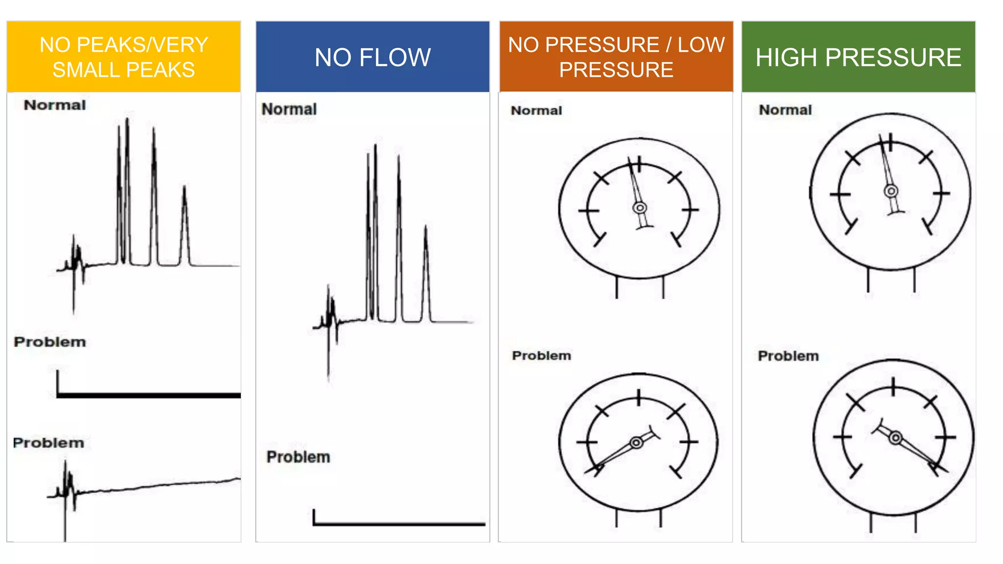 HIGH PRESSURE
NO PRESSURE / LOW
PRESSURE
NO FLOW
NO PEAKS/VERY
SMALL PEAKS
 