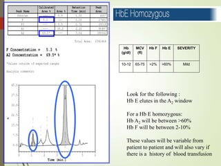 Hb
(g/dl)
MCV
(fl)
Hb F Hb E SEVERITY
10-12 65-75 >2% >60% Mild
Look for the following :
Hb E elutes in the A2 window
For a Hb E homozygous:
Hb A2 will be between >60%
Hb F will be between 2-10%
These values will be variable from
patient to patient and will also vary if
there is a history of blood transfusion
 